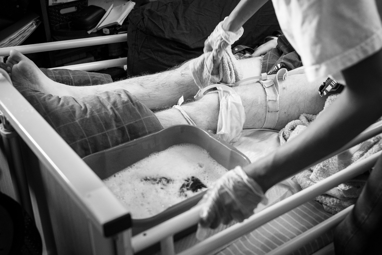 Black and white photograph showing an individual's legs being washed by his personal assistant.
