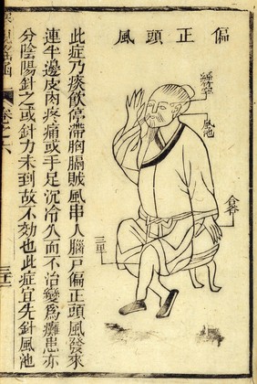 Fu Jen-yu, Compendium of Ophthalmology, 1644