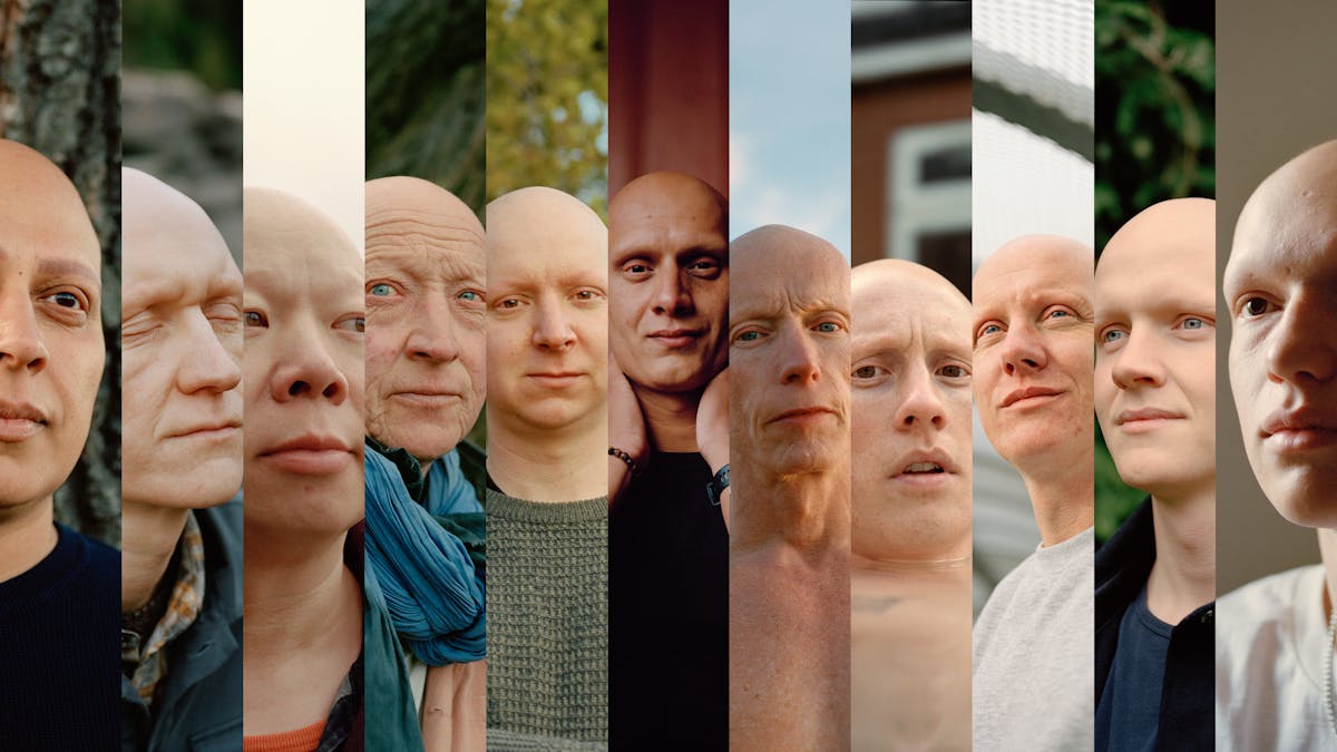 Photographic composite image of 11 portraits featuring men with alopecia universalis.